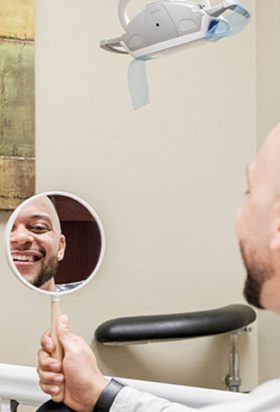 Veneers