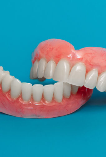 Is it best to get immediate dentures or wait?