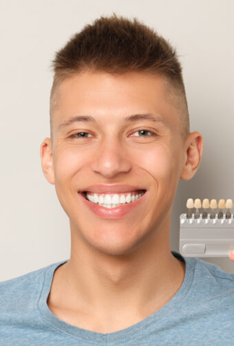What Is the Recovery Process After Getting Dental Veneers?