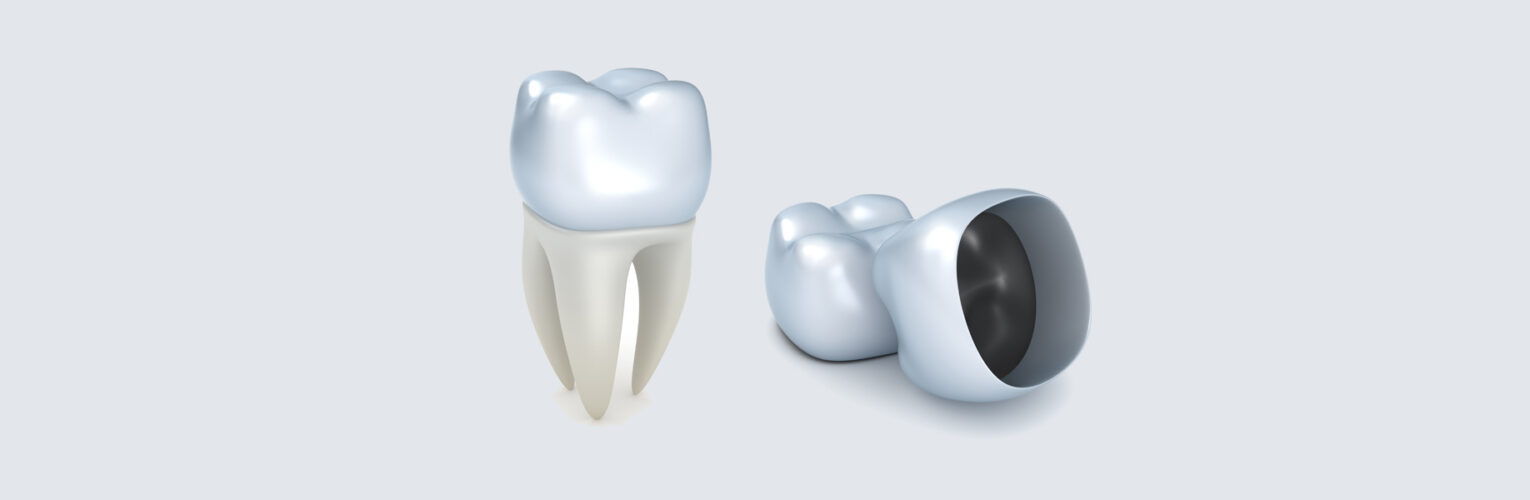 How Dental Crowns Improve the Appearance of Your Smile?