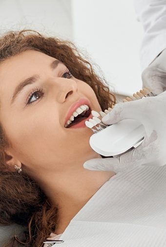What Teeth Are Suitable for Veneers?