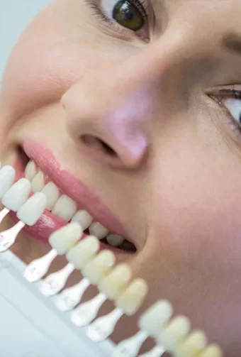 Smile Brighter with Dental Veneers in Las Vegas: Procedure, Care, and Results