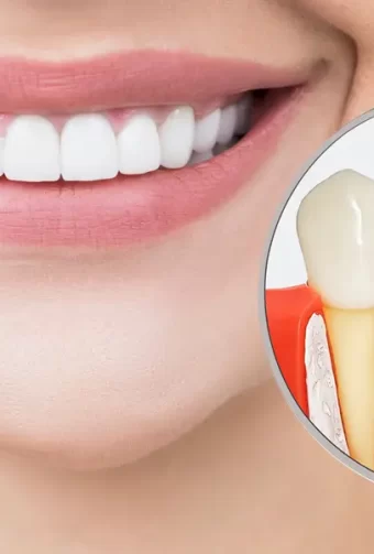 Are Dental Implants Worth It? A Las Vegas Patient’s Guide to Long-Term Value