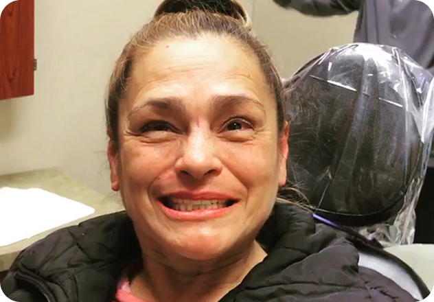 What Are Dentures?