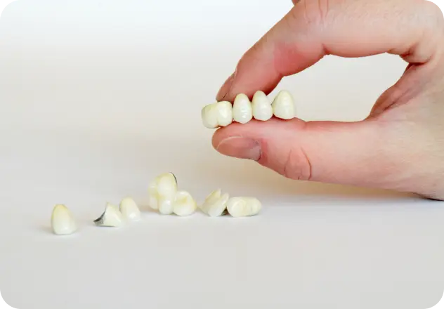 Why your dentist may recommend a dental crown