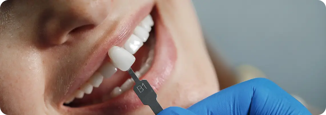 Will The Implant Appear Natural